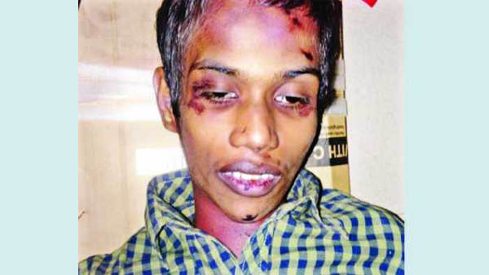 ‘রাখা হতো টয়লেটে পেটানো হতো অজ্ঞান না হওয়া পর্যন্ত’