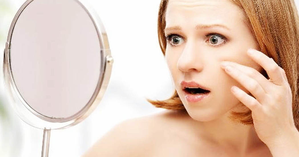 ঘরোয়া উপায়ে দূর করুন মুখের ব্রণ