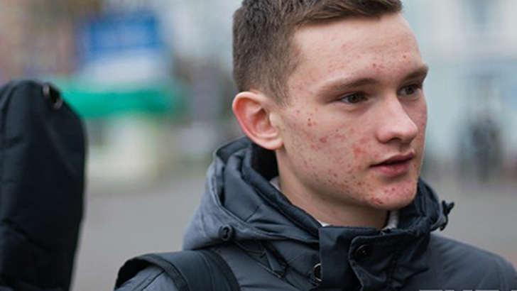 দাড়ি না গজালে কী করবেন?