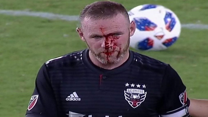 ওয়েন রুনির নাক ফাটিয়ে দিল প্রতিপক্ষ খেলোয়াড়