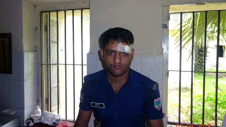 কালিয়ায় হাতকড়া নিয়ে পালাল আসামি, কনস্টেবল আহত