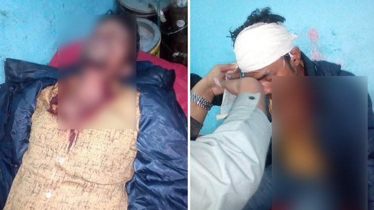 মির্জা ফখরুলের পোস্টার ছেঁড়া নিয়ে আ'লীগ-বিএনপি সংঘর্ষ