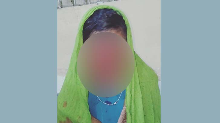 মাধবপুরে ঘুমন্ত দুই বোনের শরীর ঝলসে দিল দুর্বৃত্ত