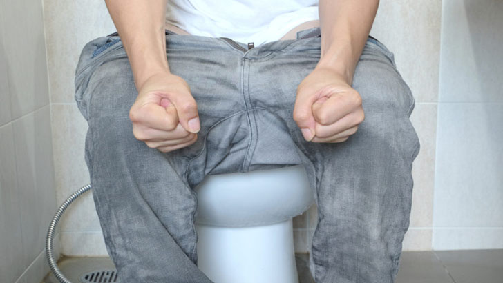 ফিস্টুলা রোগ কী? জেনে নিন কারণ ও লক্ষণ