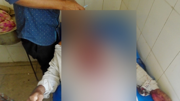 গৌরীপুরে অতিরিক্ত ভাড়ার প্রতিবাদ করায় রক্তাক্ত ট্রেনযাত্রী