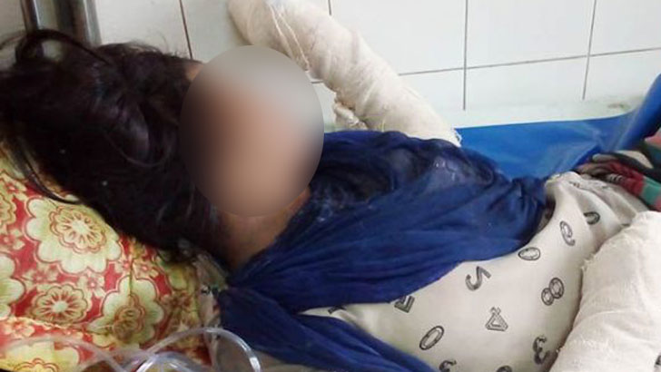 নরসিংদীতে একই পরিবারের দগ্ধ ৪, ঢামেকে ভর্তি