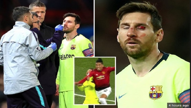 মেসির রক্তঝরা ম্যাচ জিতে সেমির পথে বার্সা