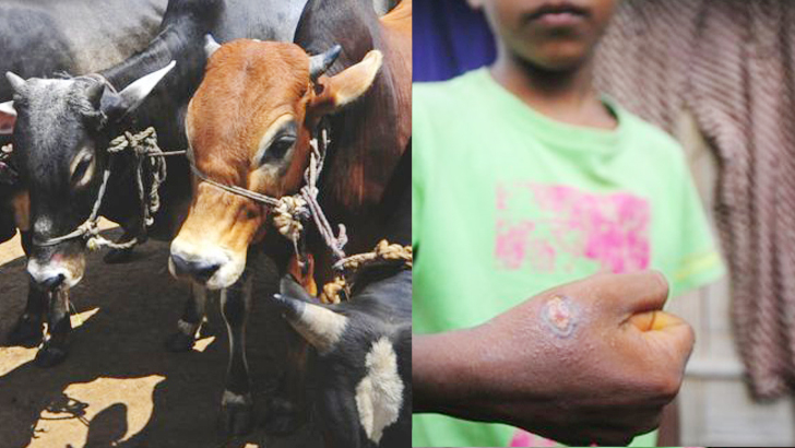 আবারও  ছড়াচ্ছে অ্যানথ্রাক্স, কী করবেন?