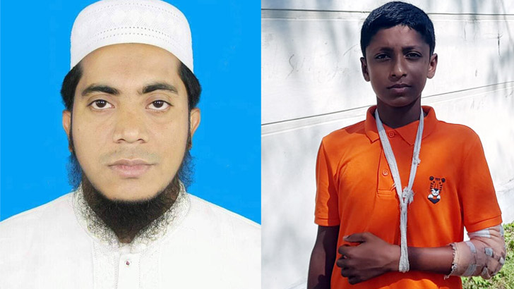 নোয়াখালীতে ছাত্রকে পিটিয়ে হাত ভেঙ্গে দিল মাদ্রাসার শিক্ষক