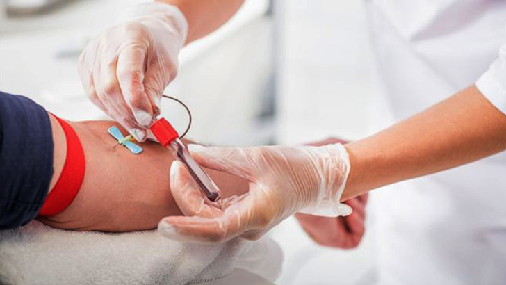 শারীরিক সম্পর্ক ছাড়াও যে ৬ কারণে  এইডস হতে পারে