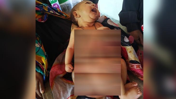 মাত্র তিন লাখ টাকায় বেঁচে যাবে শিশু সানাউল!