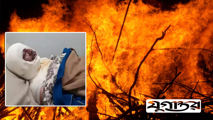 বাংলাদেশির শরীরে কেরোসিন ঢেলে আগুন দিল আফ্রিকান সন্ত্রাসী