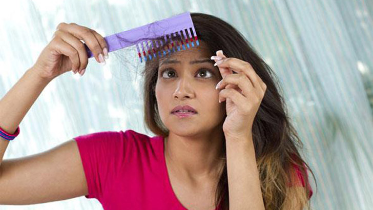 অতিরিক্ত চুল পড়া বন্ধের ঘরোয়া সমাধান