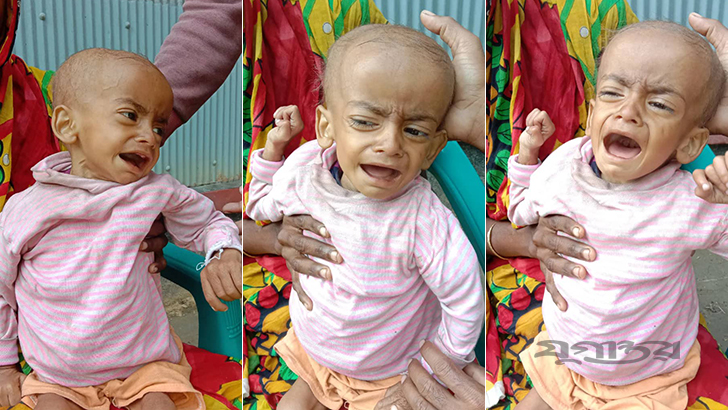 পৃথিবীতে গরীব হয়ে জন্মানো সবচেয়ে ব্যয়বহুল বিষয়