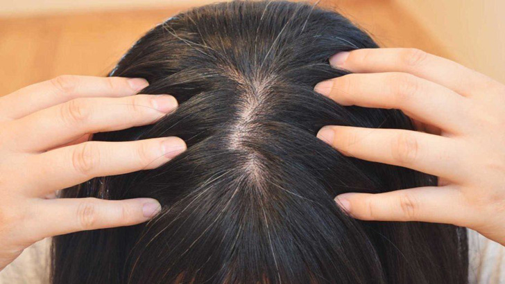 চুল পাতলা হয়ে যাচ্ছে, কী করবেন?