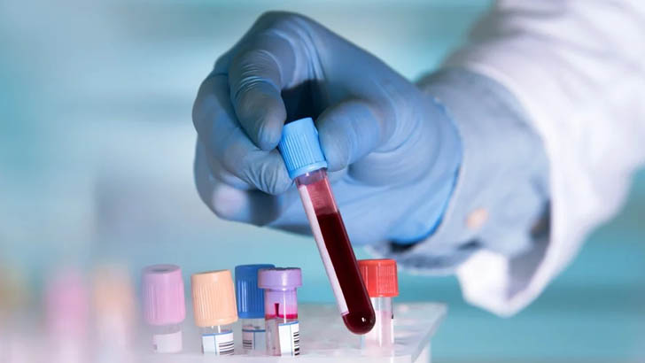 যে রক্তের গ্রুপে করোনা ঝুঁকি বেশি, জানলেন চীনের গবেষক দল