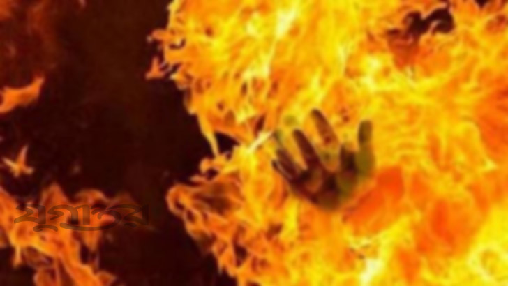 কিশোরগঞ্জে বাবা-মায়ের পর অগ্নিদগ্ধ ছেলের মৃত্যু