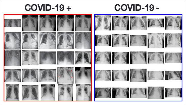 এআই বা সফটওয়্যার দিয়ে কি করোনা সনাক্ত সম্ভব?
