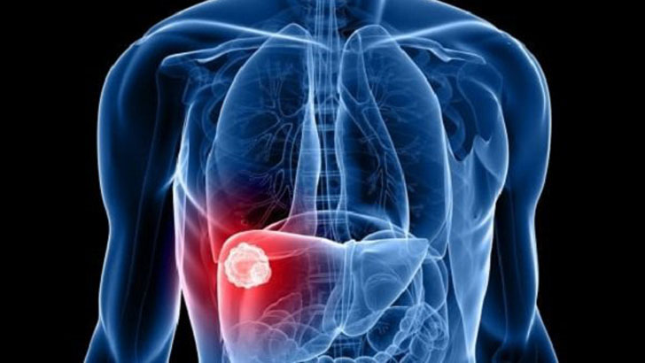 মোবাইলে সেবা মিলবে যে ৩০ জন লিভার বিশেষজ্ঞের