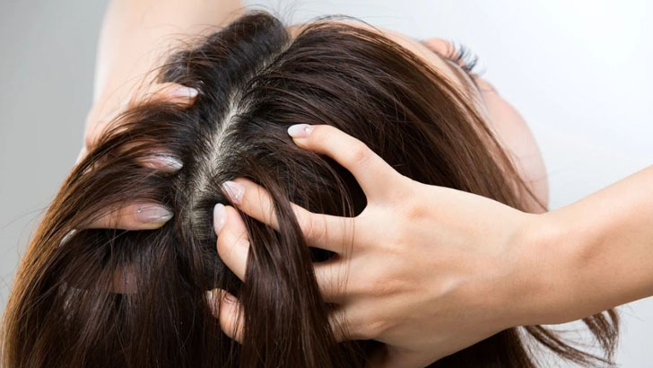 চুল পড়া বন্ধ করার ঘরোয়া ৫ উপায়