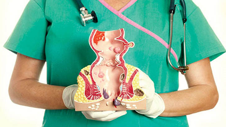 পাইলসের রোগীরা যেসব খাবার খাবেন না