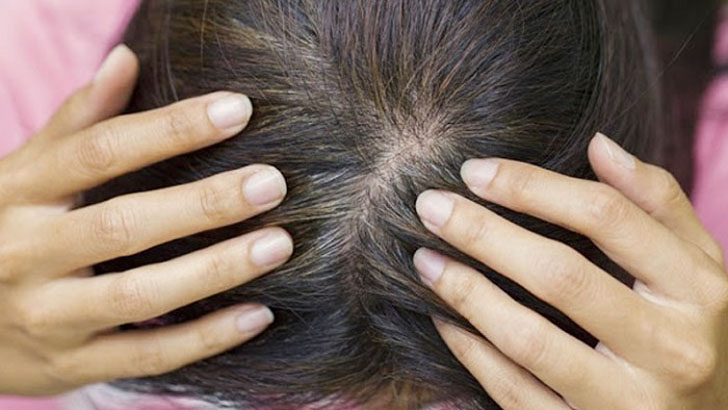 যেসব অভ্যাস ত্যাগ করলে চুল পড়া কমবে