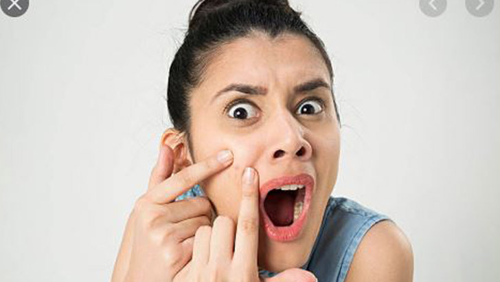 ব্রণের দাগ দূর করতে চিকিৎসকের পাঁচ পরামর্শ