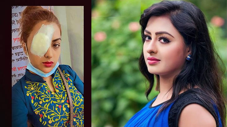 রোদে গলে গেল অভিনেত্রীর কন্টাক্ট লেন্স, বিমানে ঢাকায় 