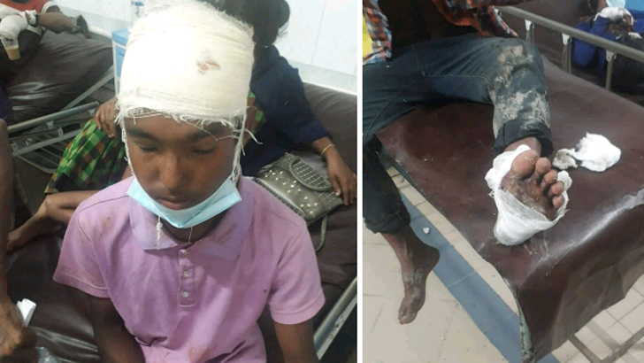 ইমাম-মুয়াজ্জিনকে খাওয়ানো নিয়ে সংঘর্ষে গুলিবিদ্ধসহ আহত ৪০