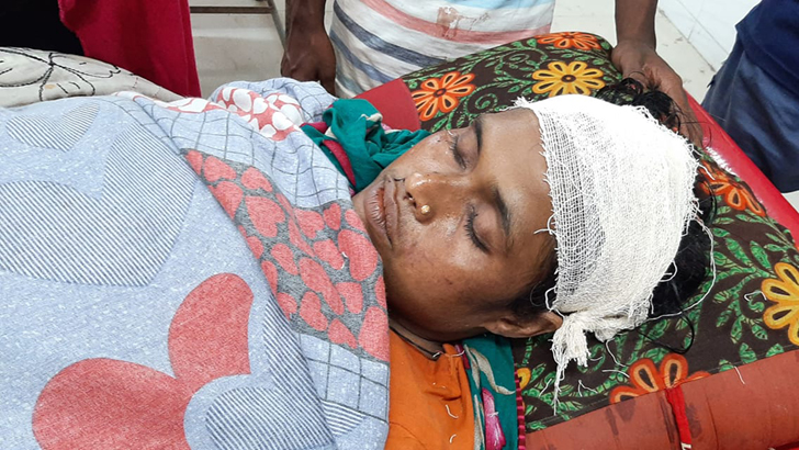 পিটিয়ে গৃহবধূর মাথা ফাটিয়ে দিল পুলিশ