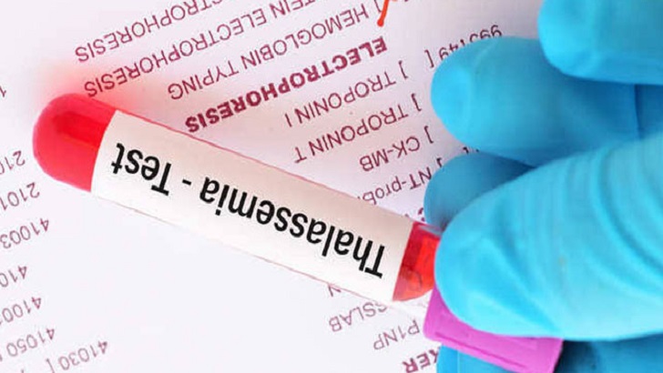 থ্যালাসেমিয়া কোনো ছোঁয়াচে রোগ নয়