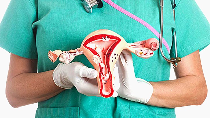 জরায়ুর টিউমার ও করণীয়