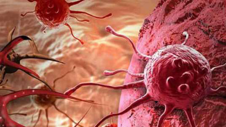 বাংলাদেশে ক্যান্সার চিকিৎসায় যেসব চ্যালেঞ্জ রয়েছে