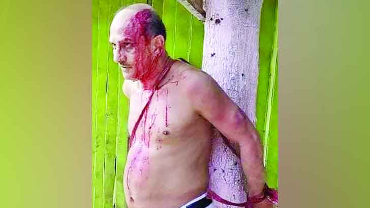 পটিয়ায় আ.লীগ নেতাকে গাছে বেঁধে মারধর