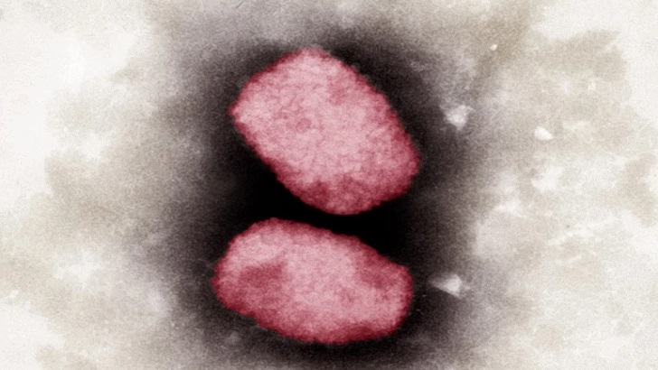 বিশ্বের ২২ দেশে ছড়াল মাঙ্কিপক্স