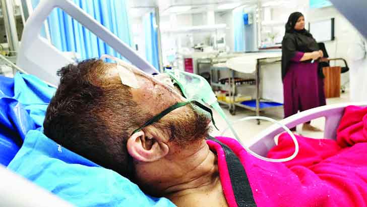 ঢাকায় ভর্তি ১৪ জনের অনেকেরই অবস্থা সংকটাপন্ন
