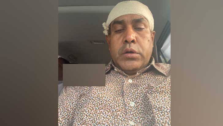 কৃষক লীগ নেতার ওপর হামলার অভিযোগে বিএনপি-আ.লীগ নেতার বিরুদ্ধে মামলা