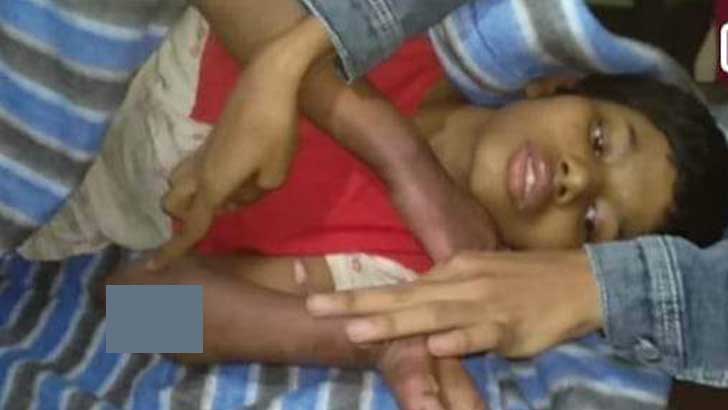 নির্যাতনের পর গরম পানি দিয়ে ঝলসানো হয় সুমাইয়ার শরীর