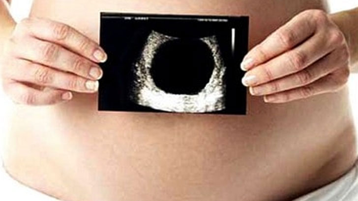 যে রোগে নিজেকে গর্ভবতী মনে করেন নারীরা