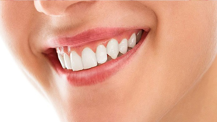 মুখ ও দাঁতের যত্ন কীভাবে নেবেন