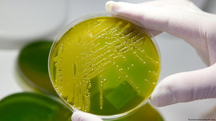 বাংলাদেশে ভয়াবহ আকার ধারণ করছে ‘সেপসিস’