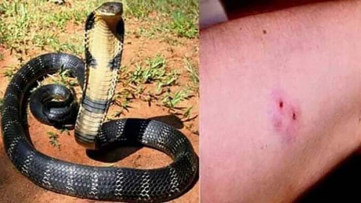 সাপে কাটা রোগীর চিকিৎসায় অবহেলা নয়
