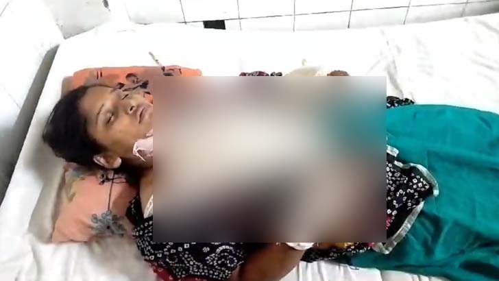 গৃহবধূর শরীরে কেরোসিন ঢেলে আগুনে ঝলসে দেওয়ার অভিযোগ