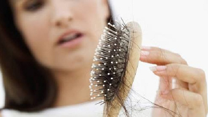 চুল কেন পড়ে?