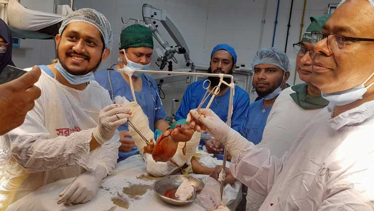 গাজীপুরে শিশুর ভেতর জন্ম নেওয়া শিশু অপসারণ