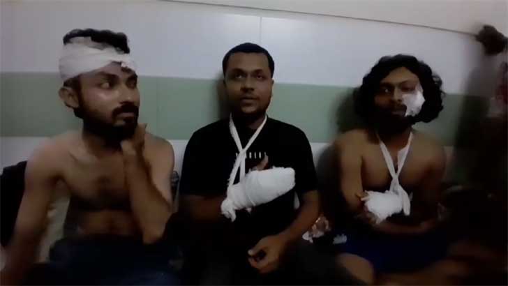 সন্ত্রাসীদের হামলায় আহত বাগেরহাটের বৈষম্যবিরোধী ছাত্র আন্দোলনের তিন নেতা