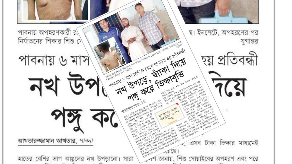 নখ উপড়ে, ছ্যাঁকা দিয়ে পঙ্গু করে ভিক্ষাবৃত্তি