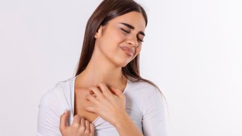 গরমে চুলকানি আর ঘামাচি ভোগাচ্ছে, জেনে নিন ৯ টিপস