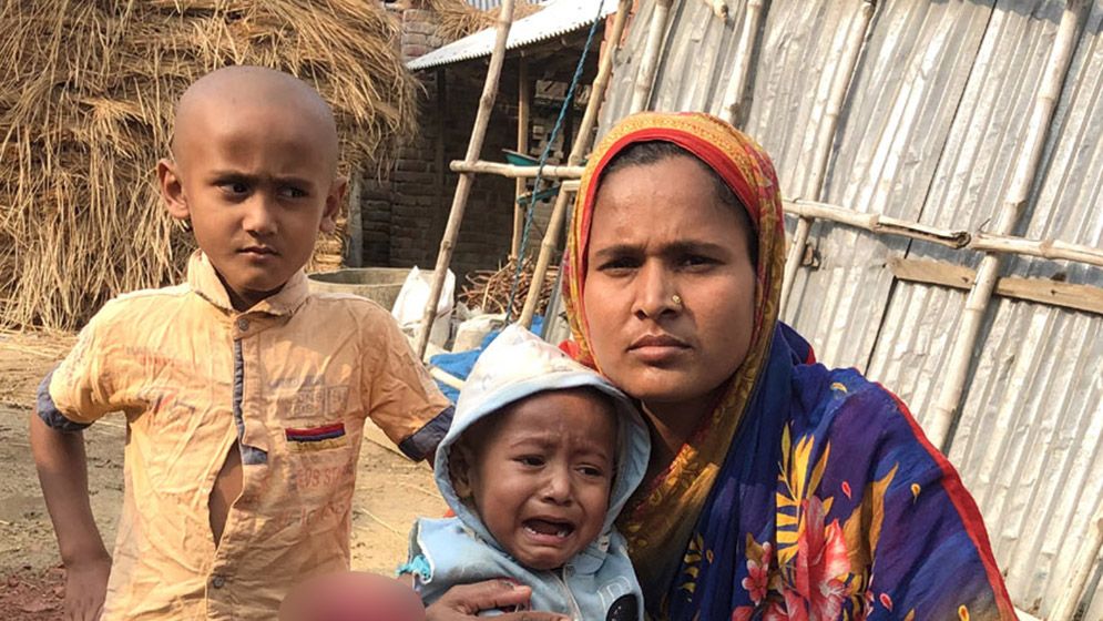 অগ্নিদগ্ধ সন্তানকে বাঁচাতে মায়ের আকুতি