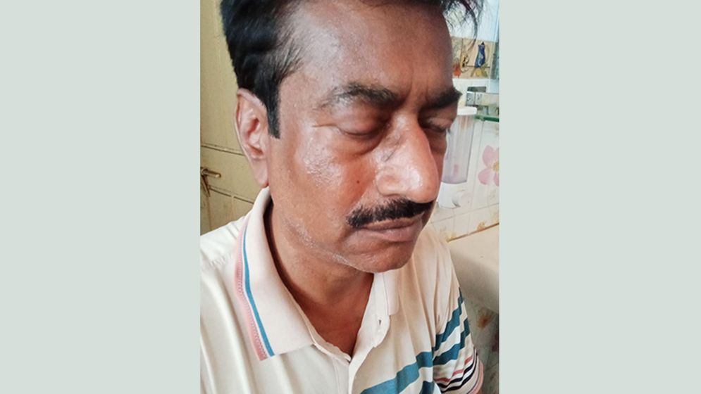 বিএনপি নেতার মারপিটে যুবদল নেতা আহত